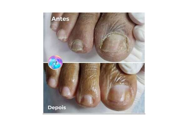 Foto de antes e depois do tratamento 18